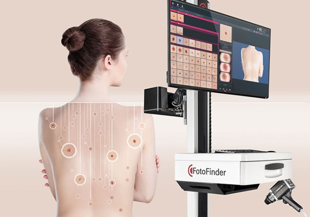 Total Body Mapping - Hautkrebsfrüherkennung bei Dr. Michael MAndl in Salzburg _ ATBM, Automated Total Body Mapping